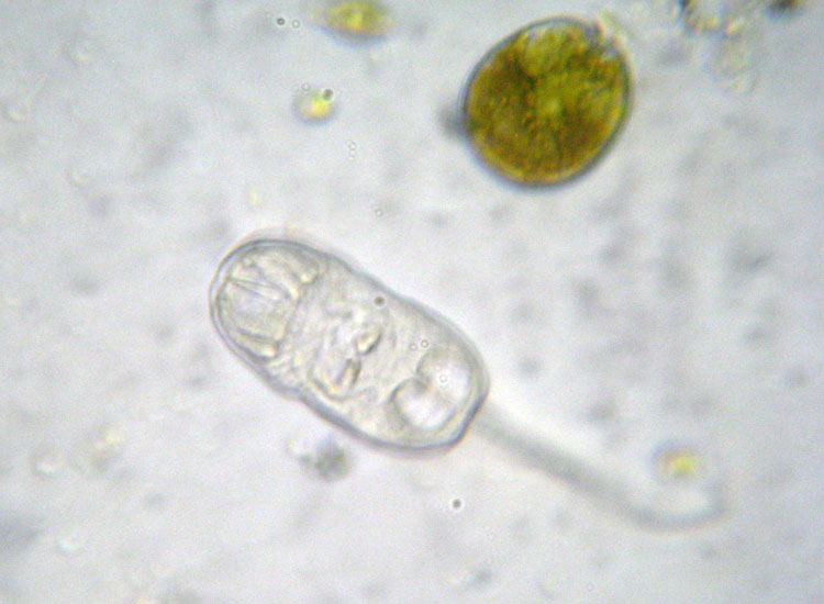 Larva di ascidiacea?